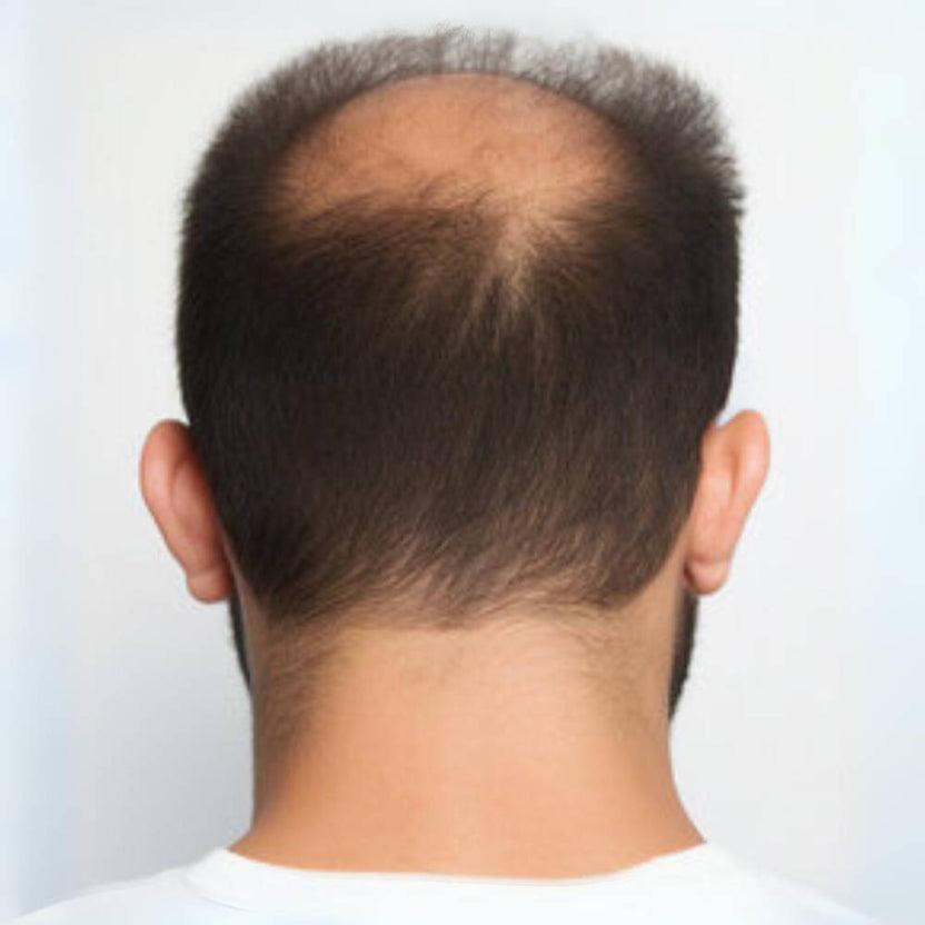 Hair Revive Pro™ Luminova